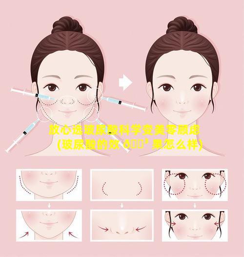 放心选玻尿酸科学变美零顾虑(玻尿酸的效 🌳 果怎么样)